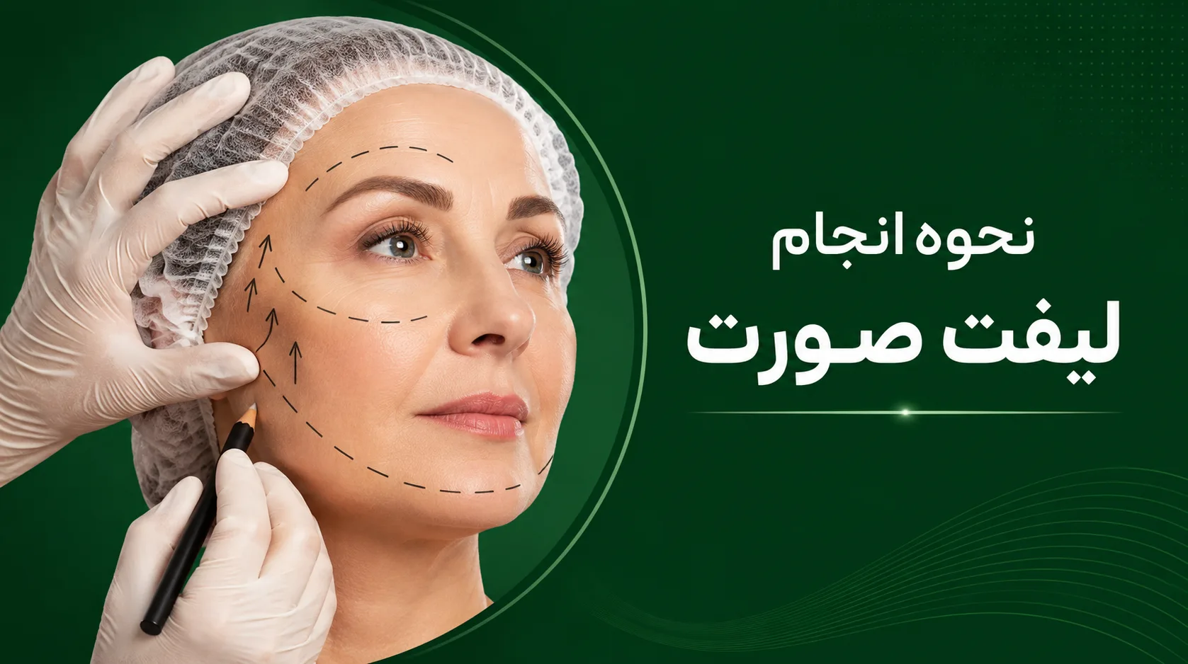نحوه انجام لیفت پوست صورت